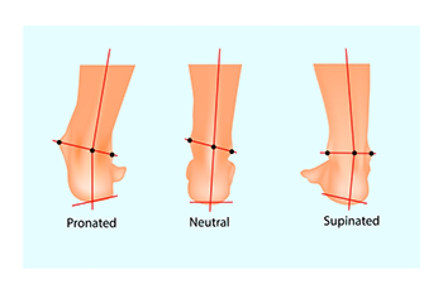 Pronation and Supination of the Feet