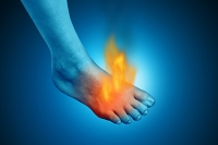 Foot Burn Wound Care